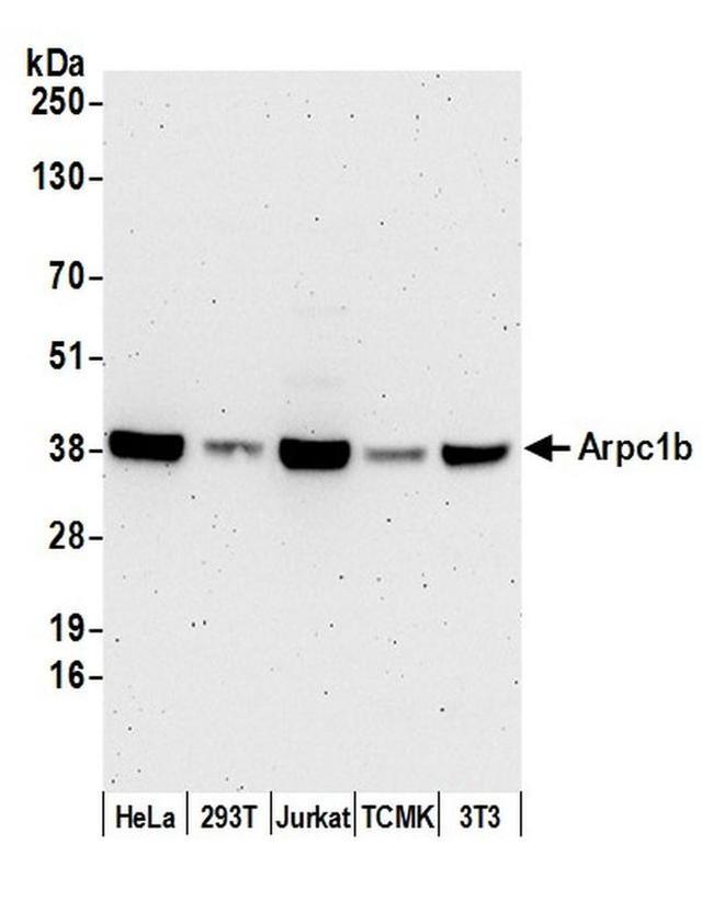 Arpc1b Antibody in Western Blot (WB)