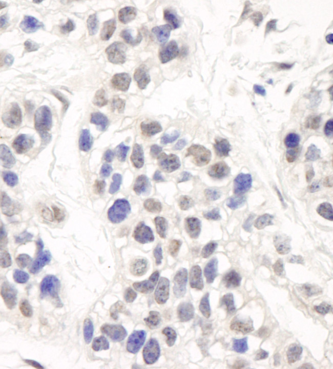 Artemis Antibody in Immunohistochemistry (IHC)