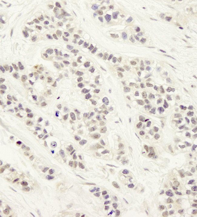 Artemis Antibody in Immunohistochemistry (IHC)