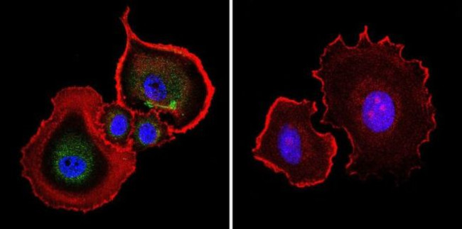 AHR Antibody in Immunocytochemistry (ICC/IF)