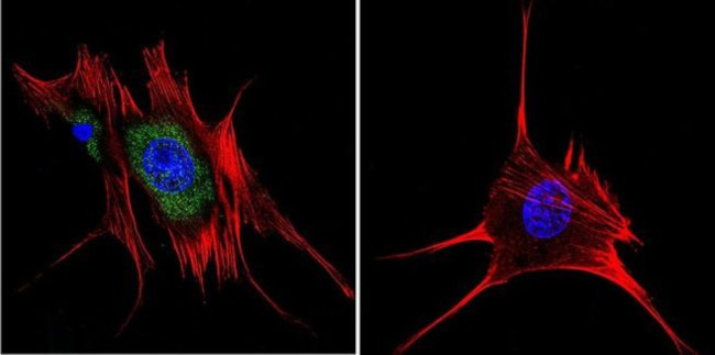 AHR Antibody in Immunocytochemistry (ICC/IF)