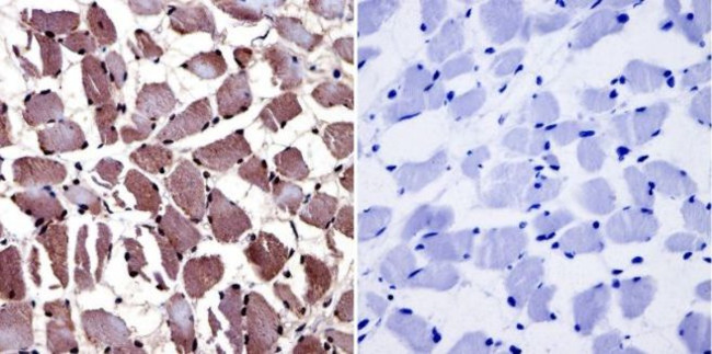 AHR Antibody in Immunohistochemistry (Paraffin) (IHC (P))