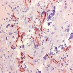 Aspergillus Antibody in Immunohistochemistry (Paraffin) (IHC (P))