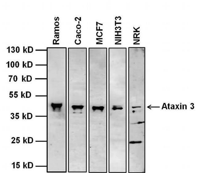 Ataxin 3 Antibody in Western Blot (WB)