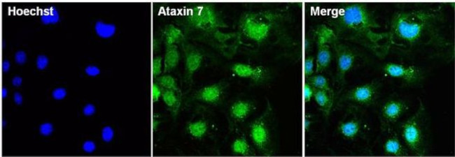 Ataxin 7 Antibody in Immunocytochemistry (ICC/IF)