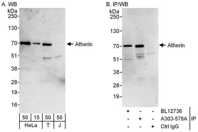 Atherin Antibody in Western Blot (WB)