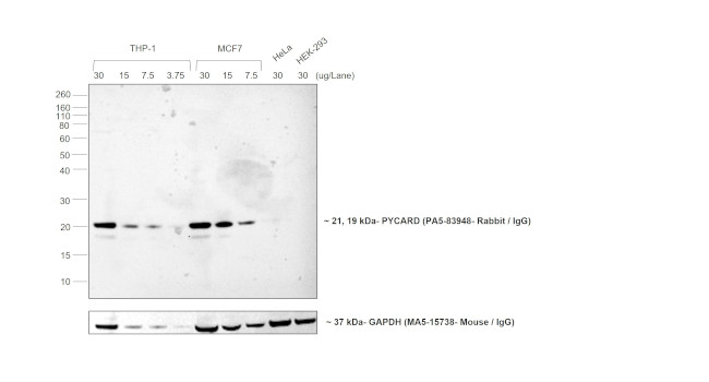 Rabbit IgG (H+L) Cross-Adsorbed Secondary Antibody in Western Blot (WB)