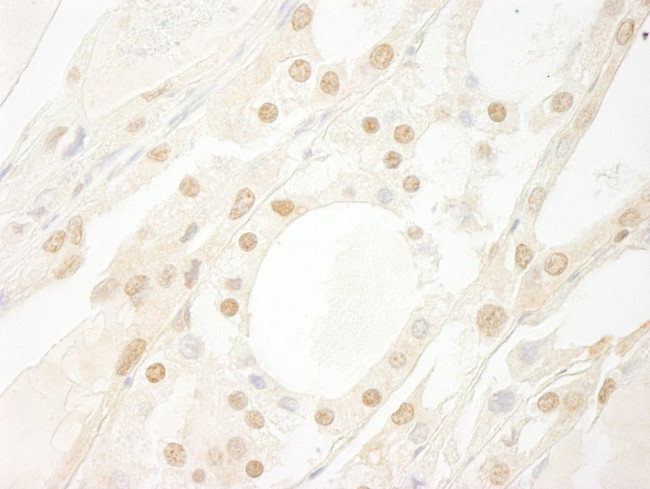 B-Myb Antibody in Immunohistochemistry (IHC)