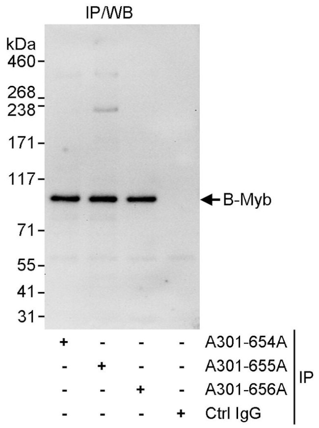 B-Myb Antibody in Immunoprecipitation (IP)