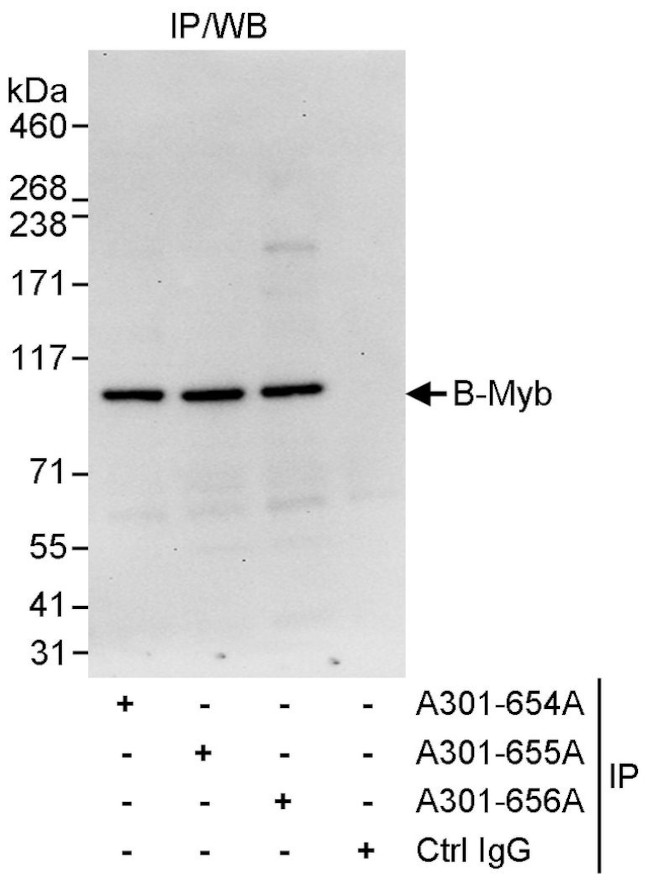 B-Myb Antibody in Immunoprecipitation (IP)