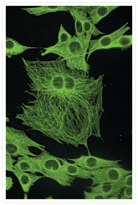 Mouse IgG (H+L) Cross-Adsorbed Secondary Antibody in Immunocytochemistry (ICC/IF)