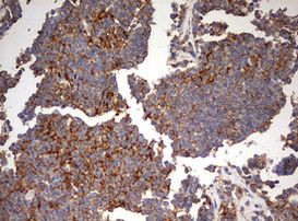 B2M Antibody in Immunohistochemistry (Paraffin) (IHC (P))