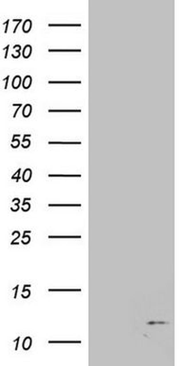 B2M Antibody in Western Blot (WB)