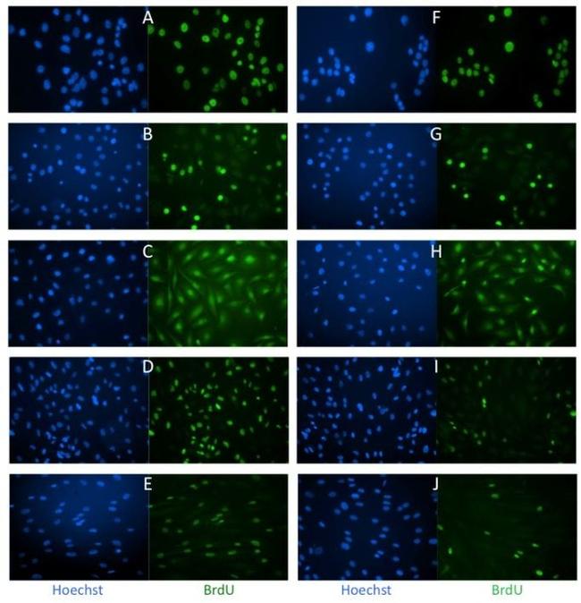 BrdU Antibody in Immunocytochemistry (ICC/IF)