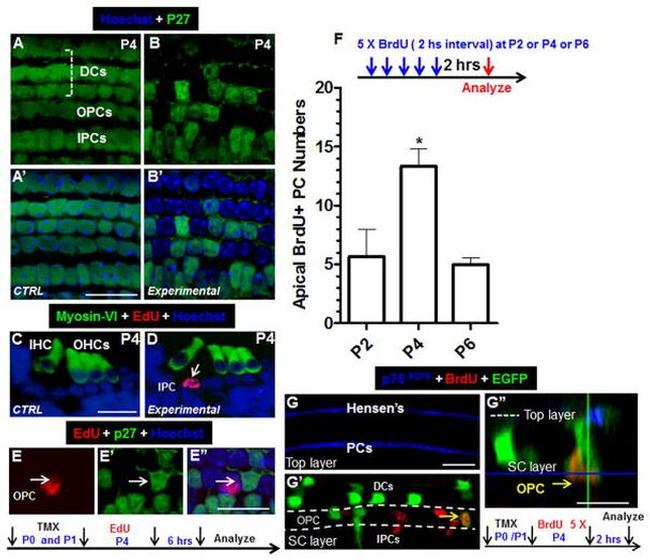 BrdU Antibody in Immunohistochemistry (IHC)