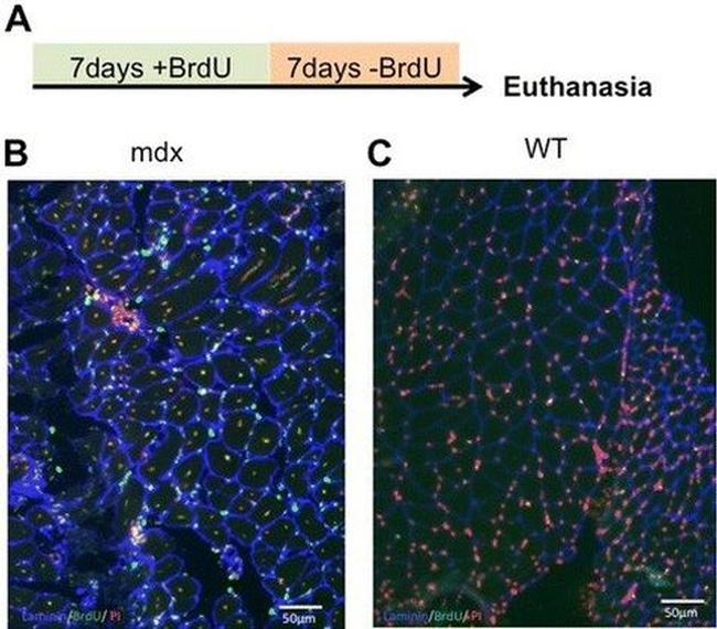 BrdU Antibody in Immunohistochemistry (IHC)