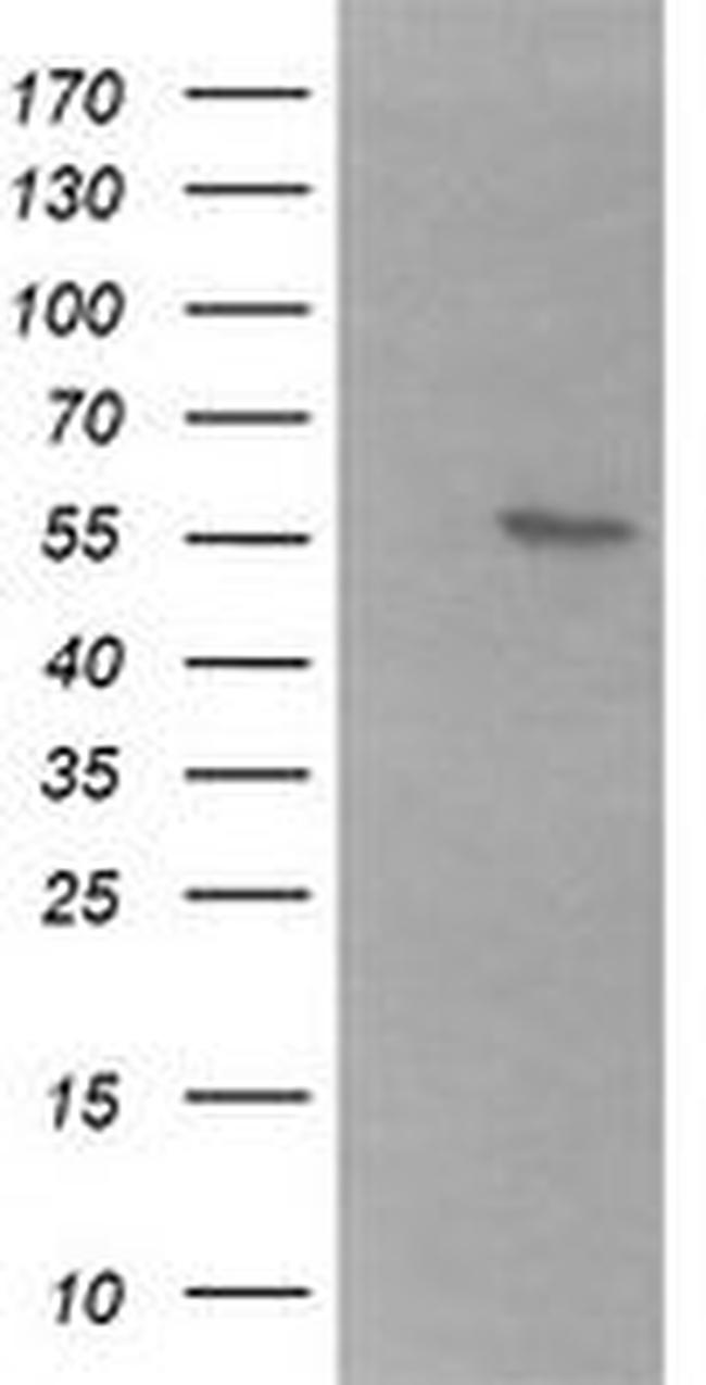 B3GALNT2 Antibody in Western Blot (WB)