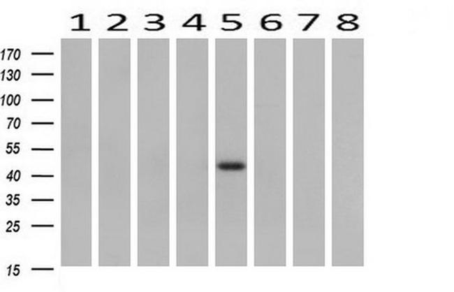 B3GNT2 Antibody in Western Blot (WB)