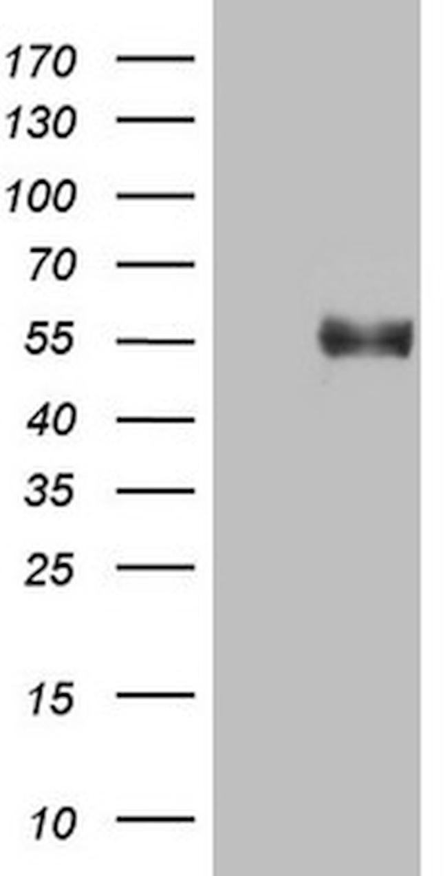 B4GALT3 Antibody in Western Blot (WB)