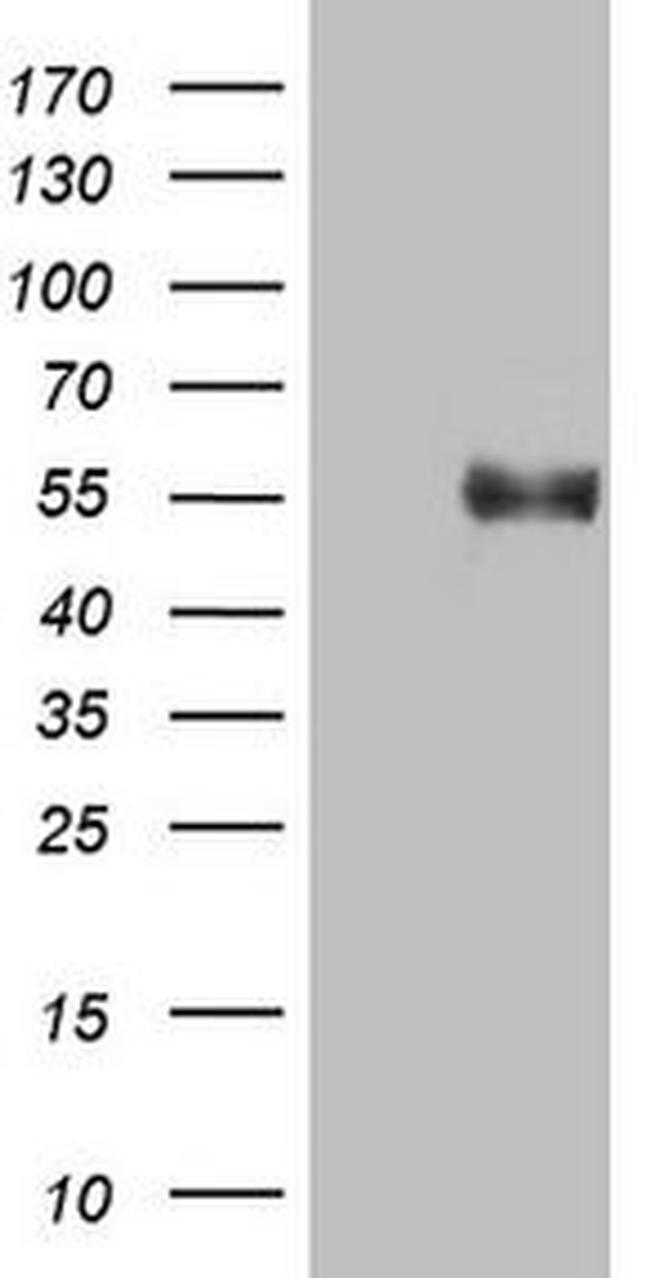 B4GALT3 Antibody in Western Blot (WB)