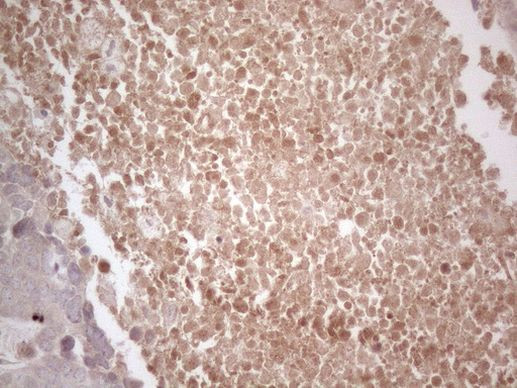 B4GALT4 Antibody in Immunohistochemistry (Paraffin) (IHC (P))