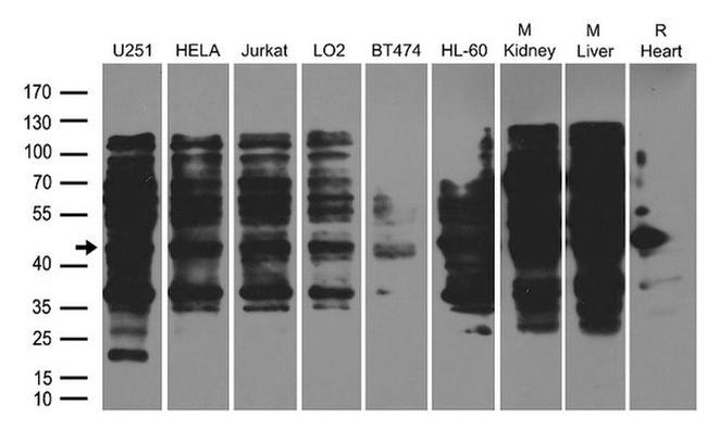 BABAM1 Antibody in Western Blot (WB)