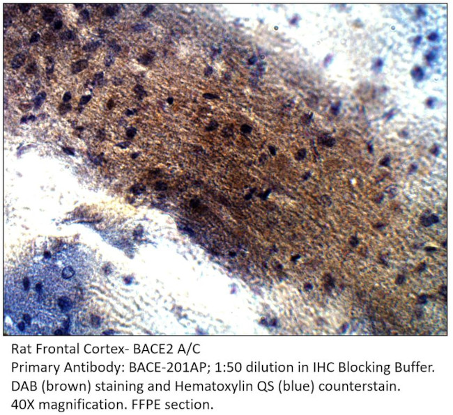 BACE2 A/C Antibody in Immunohistochemistry (IHC)