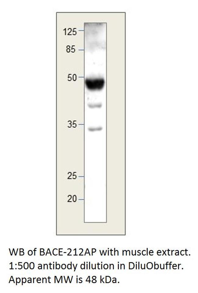 BACE2 B Antibody in Western Blot (WB)