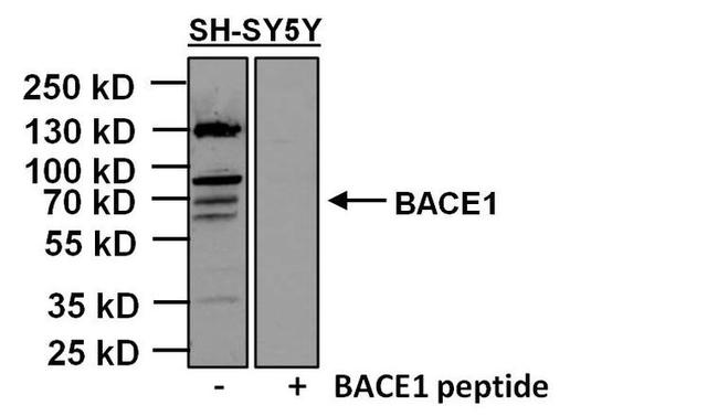 BACE1 Antibody in Western Blot (WB)