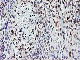 BACH1 Antibody in Immunohistochemistry (Paraffin) (IHC (P))