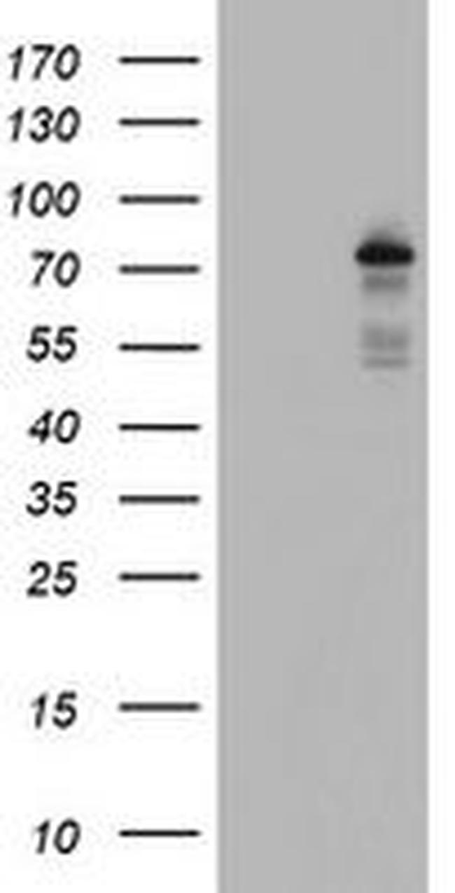 BACH1 Antibody in Western Blot (WB)