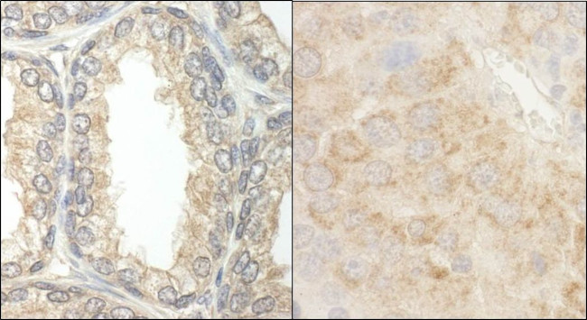 BAD Antibody in Immunohistochemistry (IHC)