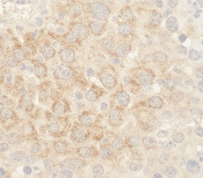 BAD Antibody in Immunohistochemistry (IHC)