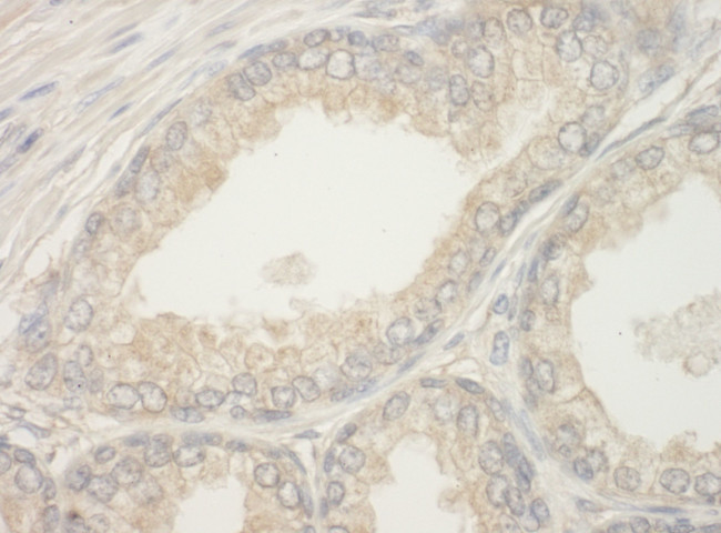 BAD Antibody in Immunohistochemistry (IHC)