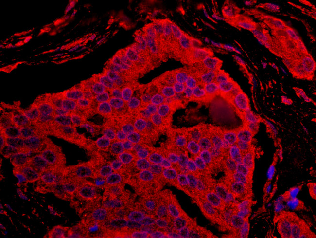 BAD Antibody in Immunohistochemistry (IHC)