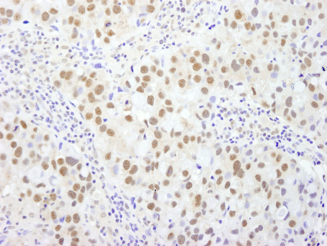 BAF53A Antibody in Immunohistochemistry (IHC)