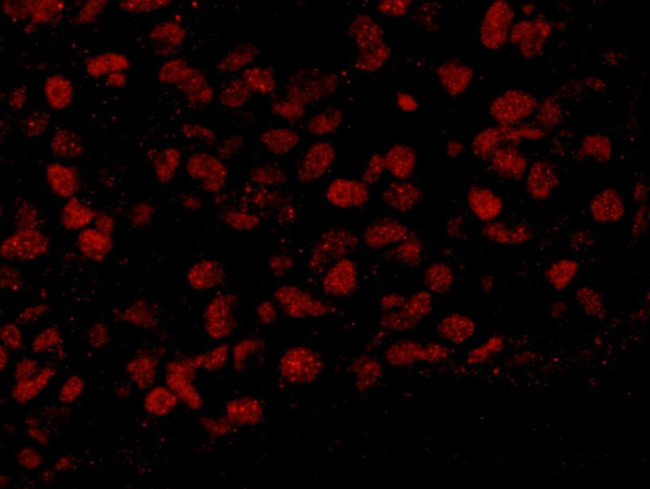 BAF53A Antibody in Immunohistochemistry (IHC)