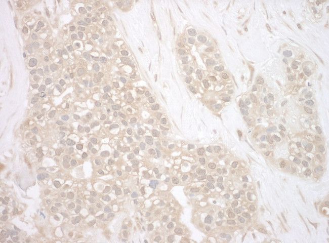 BAG3 Antibody in Immunohistochemistry (IHC)