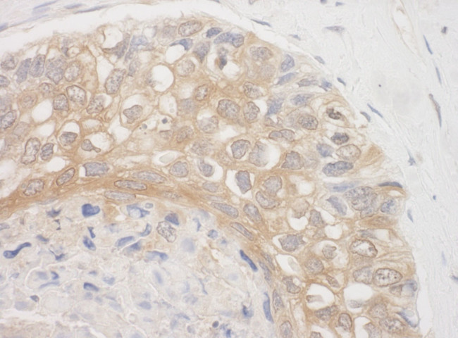 BAG3 Antibody in Immunohistochemistry (IHC)