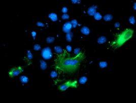 BAIAP2 Antibody in Immunocytochemistry (ICC/IF)