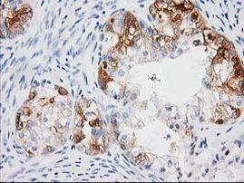 BAIAP2 Antibody in Immunohistochemistry (Paraffin) (IHC (P))