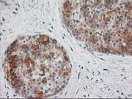 BAIAP2 Antibody in Immunohistochemistry (Paraffin) (IHC (P))