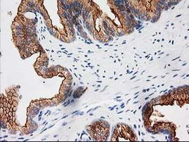 BAIAP2 Antibody in Immunohistochemistry (Paraffin) (IHC (P))