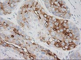 BAIAP2 Antibody in Immunohistochemistry (Paraffin) (IHC (P))