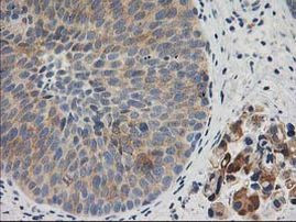 BAIAP2 Antibody in Immunohistochemistry (Paraffin) (IHC (P))