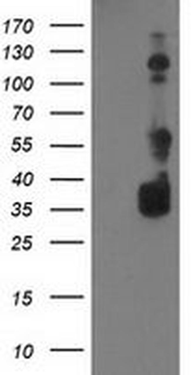 BAIAP2 Antibody in Western Blot (WB)