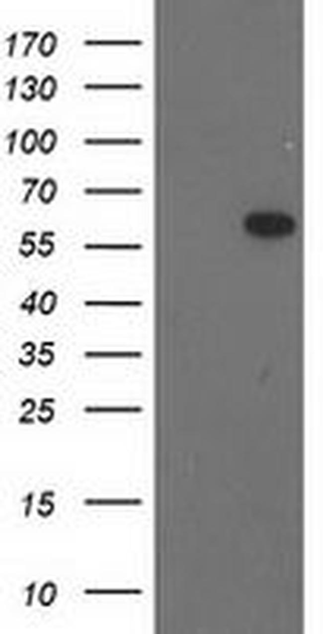 BAIAP2 Antibody in Western Blot (WB)