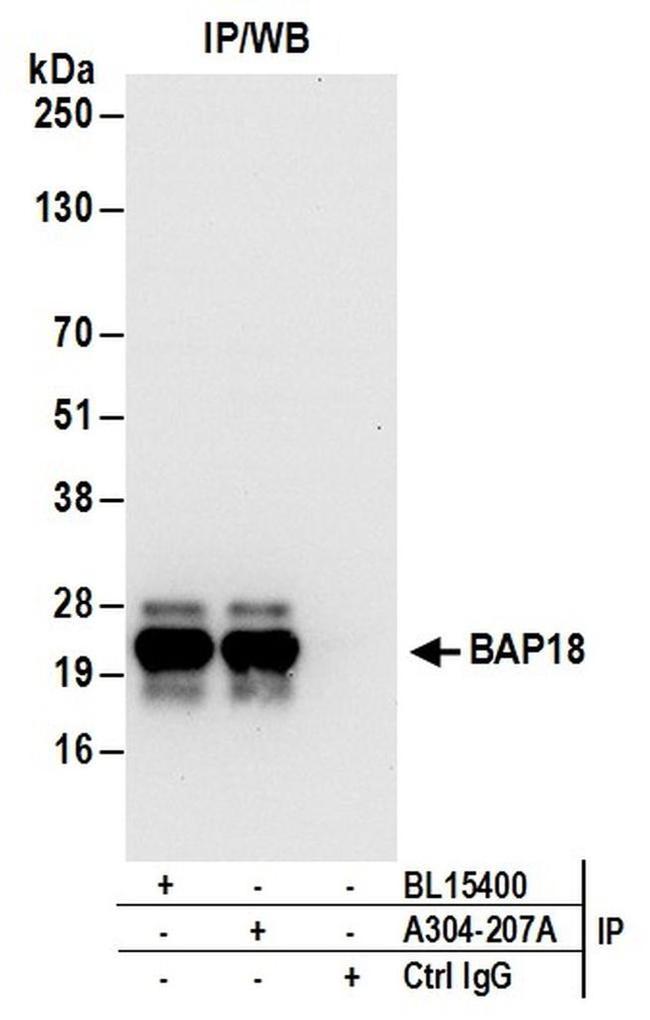 BAP18 Antibody in Western Blot (WB)