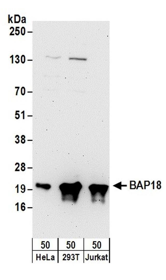 BAP18 Antibody in Western Blot (WB)