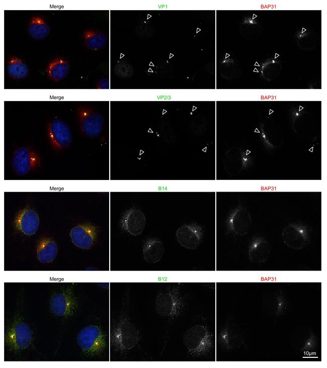 BAP31 Antibody in Immunocytochemistry (ICC/IF)